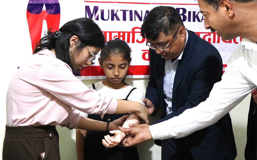 मुक्तिनाथ विकास बैंकले जव कृत्रिम हात दियो…